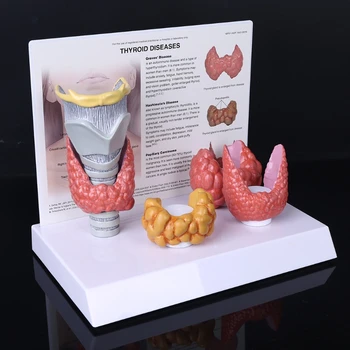 Анатомическая модель щитовидной железы человека Патология Анатомия Пищеварительная система Дисплей